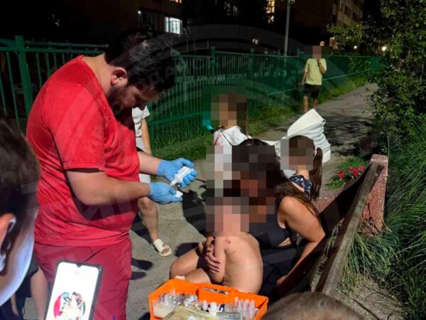 В Дагомысе собака напала на ребенка на детской площадке